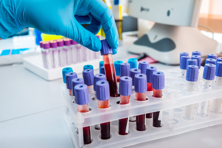 blood testing near me