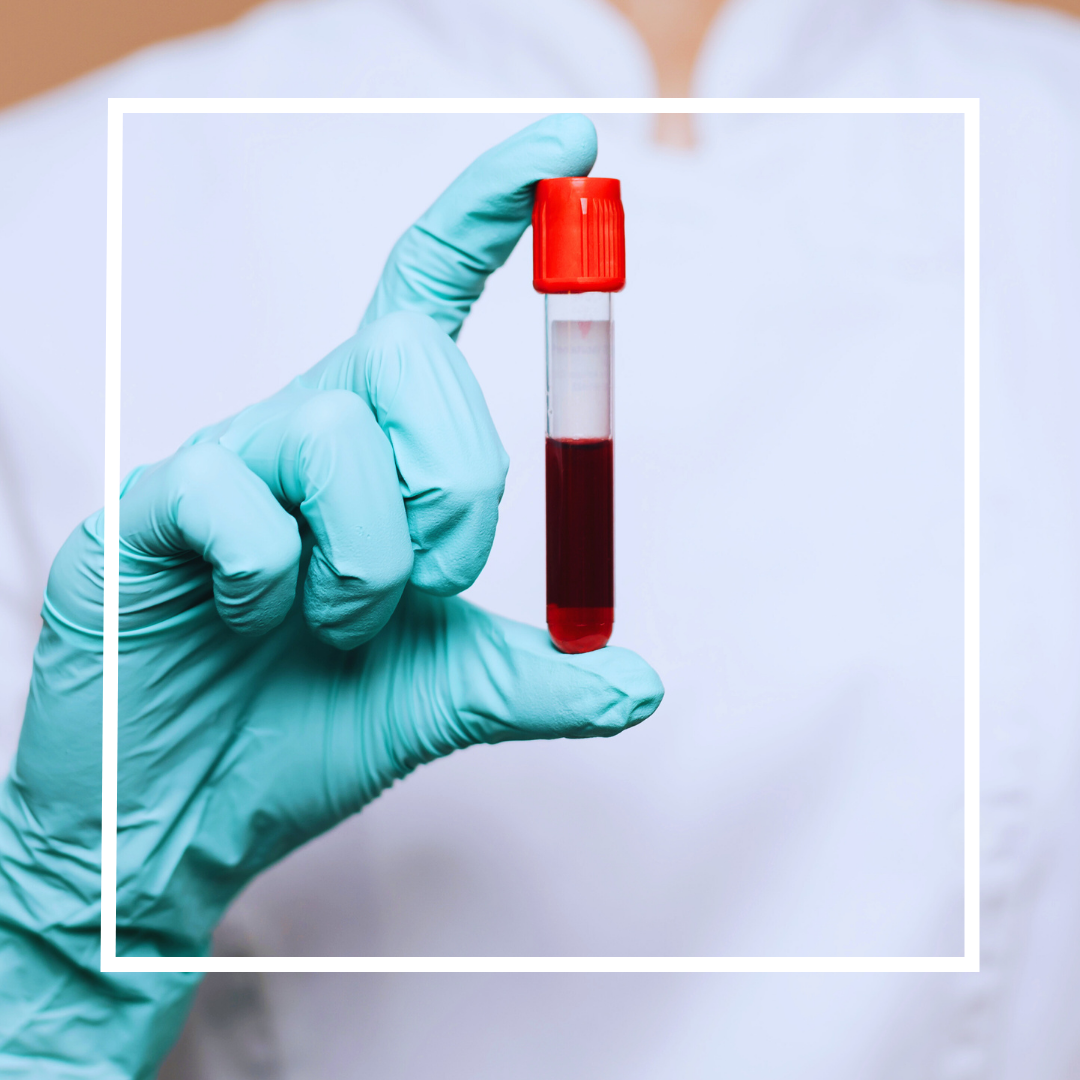 blood testing near me